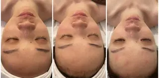 L'amour 御徒町所属・L'amour御徒町 🎀MoMo🎀のエステ・リラクイメージ