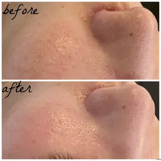 メンズ メナード岐阜市茜部 杉浦のエステ・リラクイメージ