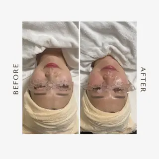 東海エリア1位受賞 長江香保のエステ・リラクイメージ