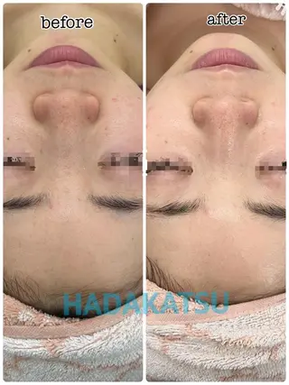 総合エステサロン 肌活のエステ・リラクイメージ