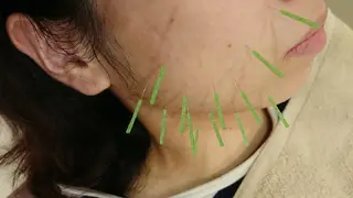 キッズ ネイル メンズ ヘアアレンジ マツエク・マツパ パーマ ロング カラー 鍼灸サロンKEYAKI所属・美容鍼灸師 皆吉 秀樹のエステ・リラクイメージ