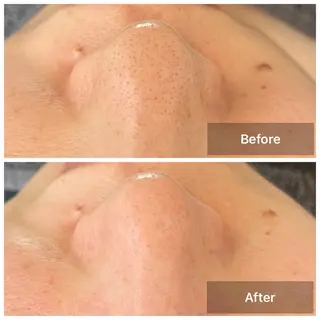 隠れ家サロン STELLA☆のエステ・リラクイメージ