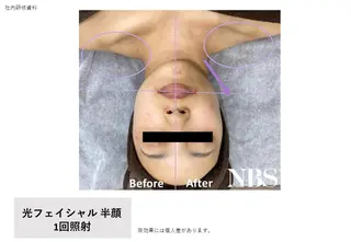 痩身・脱毛・美髪ケア 【GLYCINE】のエステ・リラクイメージ