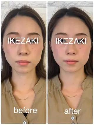 美容鍼 IKEZAKIのエステ・リラクイメージ