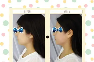 美顔ケアサロン ティアレのエステ・リラクイメージ