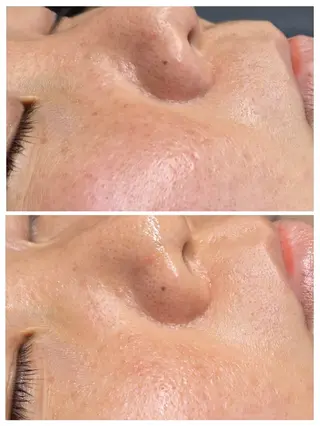 フェイシャルワックス GLOW所属・渡邊 真依のエステ・リラクイメージ