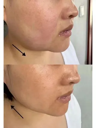 マツエク・マツパ aliaハイフ&水光ジェットサロン所属・aliaハーブ水光店 エステティシャン募集のエステ・リラクイメージ