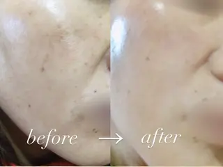 肌質改善専門  LaLuna【大阪∥本町】所属・松川 彩香のその他イメージ