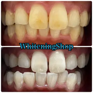 ホワイトニング ショップ吉祥寺店のエステ・リラクイメージ