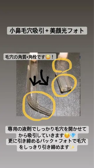 セミロング カラー パーマ ヘアアレンジ メンズ キッズ ネイル マツエク・マツパ Chloe-クロエ- 脱毛/フェイシャルのエステ・リラクイメージ