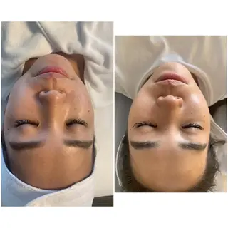 aliaハイフ&水光ジェットサロン所属・aliaハーブ水光店 エステティシャン募集のエステ・リラクイメージ