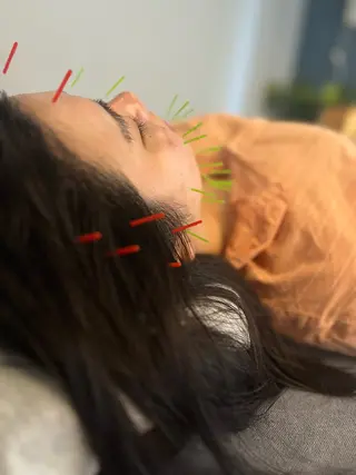 はりきゅう    SieL所属・内田 有紀のエステ・リラクイメージ