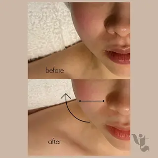 【vidyto】ヴィディトゥ所属・肌管理サロン vidyto　MOEのエステ・リラクイメージ