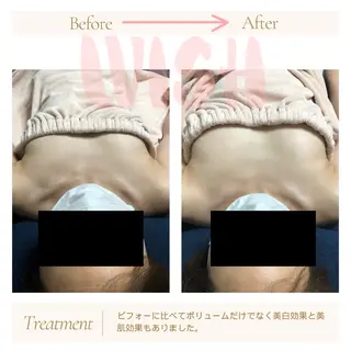 WISH 美肌脱毛のプロ！須藤のエステ・リラクイメージ