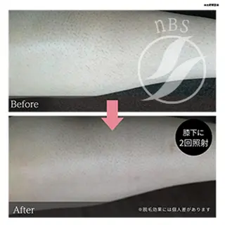 ルクール柏崎店　中村 梨子のエステ・リラクイメージ