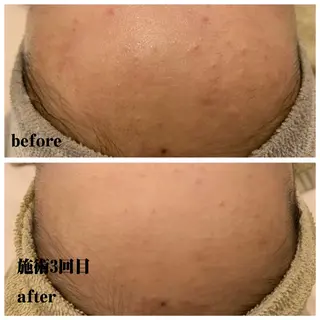 LONO  by a little所属・LONO byalittleのエステ・リラクイメージ