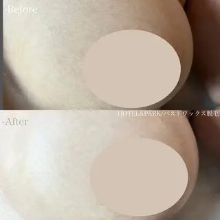 HOTEL&PARK .Moeワックス脱毛のエステ・リラクイメージ