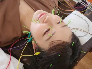 即効⚡小顔美容鍼🪡 むくみたるみ脂肪解消のエステ・リラクイメージ