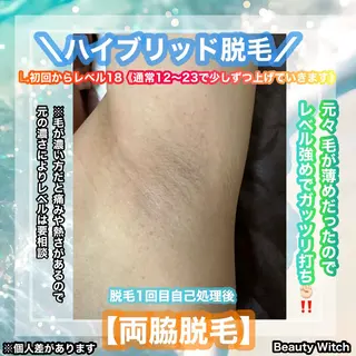 痩身/脱毛/ネイル HARUKAのエステ・リラクイメージ