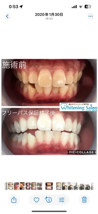 ホワイトニングサロンシフォン豊田店所属・ホワイトニングサロン シフォン豊田店のその他イメージ