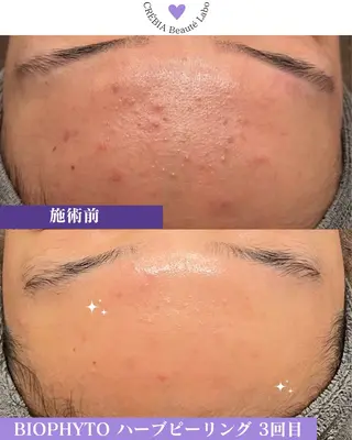 小顔＆まつ毛サロン AKANE❤️のエステ・リラクイメージ