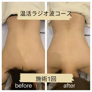 リンパマッサージ&ピラティスmimoza所属・リンパマッサージ mimozaのエステ・リラクイメージ