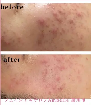 サロン　Ambelle所属・北川 亜友美のエステ・リラクイメージ