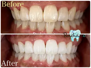 札幌ホワイトニング ラディアンス札幌駅店のその他イメージ