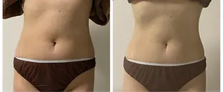 自宅サロン KaLmiaのエステ・リラクイメージ