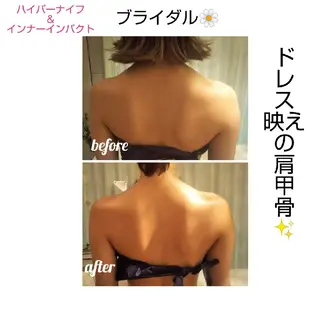 【ニキビ/肌管理】 salon varyのエステ・リラクイメージ