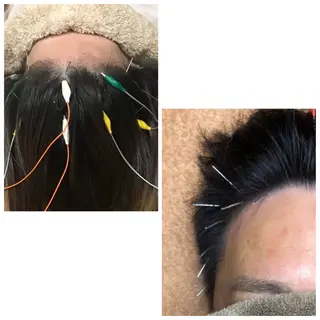 かすがい鍼灸院Re.heart所属・かすがい鍼灸院 Re.heartのエステ・リラクイメージ