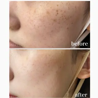 Red Moat所属・Red Moatのマツエク・マツパデザイン