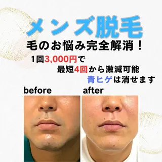 メンズ メンズ脱毛&エステ Passion所属・メンズ脱毛サロン Passionのエステ・リラクイメージ