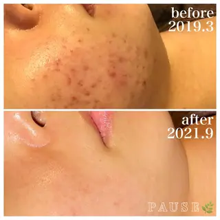 浜野 恵美のエステ・リラクイメージ