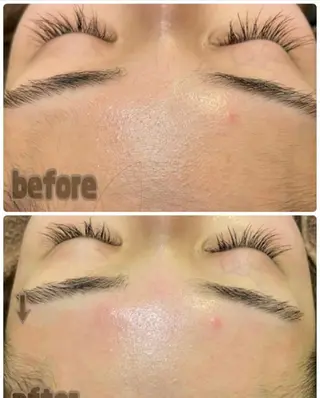 aroma  YURARI所属・韓国艶美人// 毛穴ケア🌹のエステ・リラクイメージ