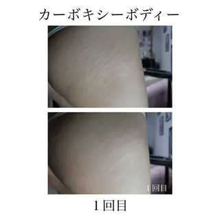 〜女性と母のための癒しサロン〜 Pua Welina所属・吉田 未優のエステ・リラクイメージ