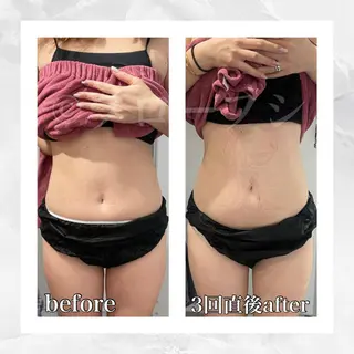 部分痩せ♥️小顔専門 MIKUのエステ・リラクイメージ