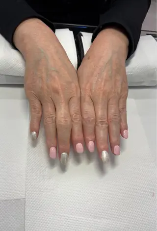 ネイル 楠本 琴音のネイルデザイン