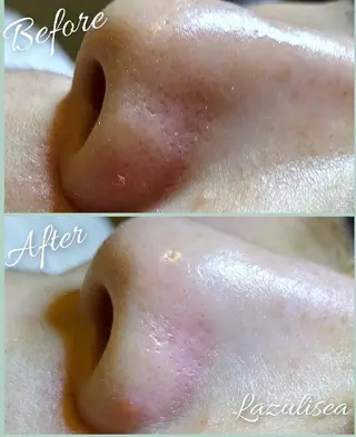 エステサロン　Lazulisea所属・川口 春奈のエステ・リラクイメージ