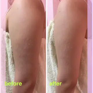 杉原 里奈のエステ・リラクイメージ