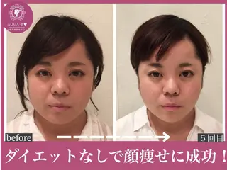 盛れる小顔矯正師 たく先生のエステ・リラクイメージ