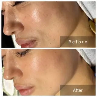 salon de perfectionのエステ・リラクイメージ