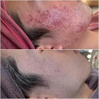 美肌蘇生カウンセラー 横山りえのエステ・リラクイメージ