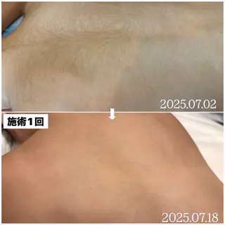 キッズ 子供脱毛専門サロンReme【リミー】所属・添田 彩葉のエステ・リラクイメージ