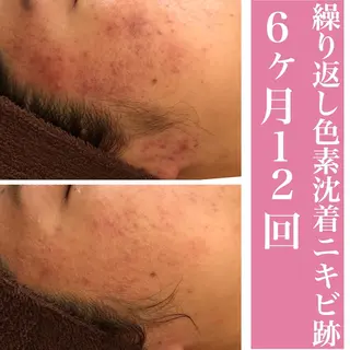 ミディアム カラー パーマ ヘアアレンジ メンズ キッズ ネイル マツエク・マツパ ニキビ・肌質改善専門 ♡人生が変わるサロンのエステ・リラクイメージ