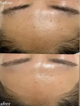 女性専門お顔剃り sunraineのエステ・リラクイメージ