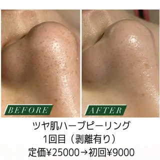 ハーブピーリング・毛穴ケア専門サロンSalon de LENA所属・ハーブピーリング 専門店/名古屋駅前店のその他イメージ