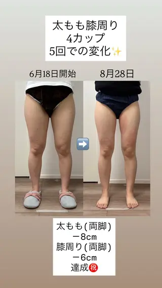 Miiju.所属・Miiju. 石巻市 脂肪冷却  鈴木のエステ・リラクイメージ