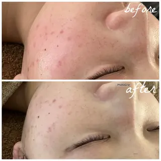 メンズ メナード岐阜茜部 杉浦のエステ・リラクイメージ