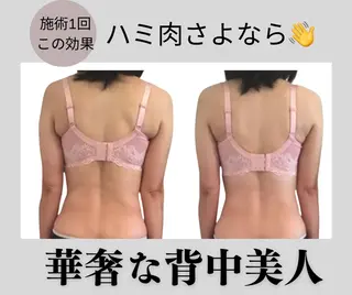 バストアップ 心斎橋ワンモアのエステ・リラクイメージ